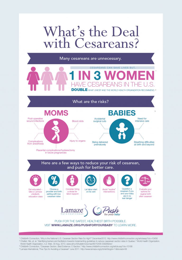 Infographic Cesarean Section Rate Is A 13 Of All Births In The Us 